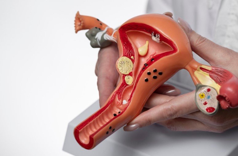 Leia mais sobre o artigo Endometriose Profunda: Entenda o Mapeamento Pélvico e o Que Ele Revela