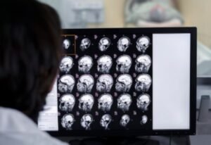 essonância Magnética vs Ultrassom