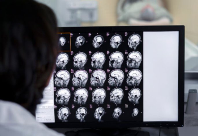 Leia mais sobre o artigo Ressonância Magnética vs Ultrassom: qual exame escolher para diferentes situações