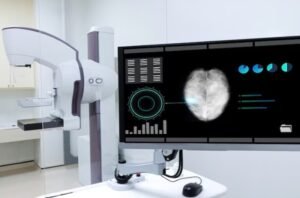 Tomossíntese Mamária