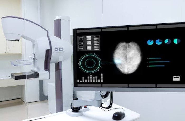 Tomossíntese Mamária